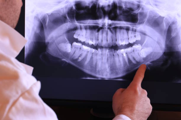 Best Dentist for Tooth Abscess  in Villanova, PA